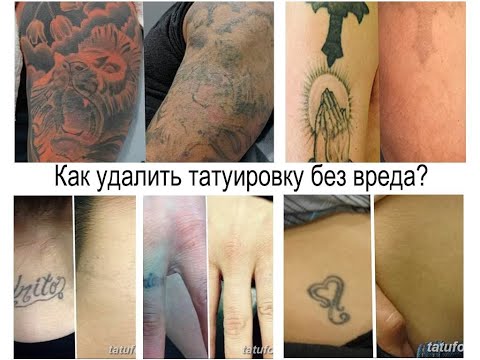 Как удалить татуировку без вреда - особенности видов и фото для сайта tatufoto.com
