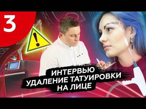 удаление татуировки на лице #удалениетату #татуналице