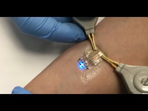 Carmel Majidi: Electronic Tattoos for Wearable Computing: Stretchable, Robust, and Inexpensive