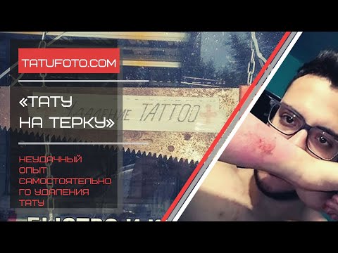 Тату на терку - неудачный опыт самостоятельного удаления тату - новость для tatufoto.com