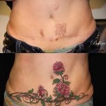 цветы вниз на живот - женская татуировка на шраме - перекрытие - фото
