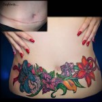 яркие цветы на живот после операции - женская татуировка на шраме - перекрытие - фото