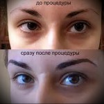 Фотография демонстрирует коррекцию бровей с помощью перманентного макияжа. Сверху - брови до процедуры, снизу - после, с более четкой и выразительной формой.