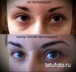 Фотография демонстрирует коррекцию бровей с помощью перманентного макияжа. Сверху - брови до процедуры, снизу - после, с более четкой и выразительной формой.