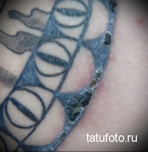 Фото татуировки: изображение поврежденной татуировки с выцветающими линиями и участками, где краска сошла с кожи.