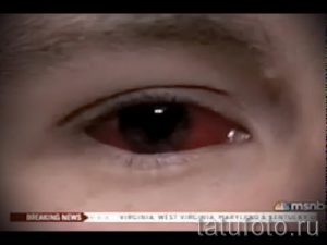 Фото тату: крупный план глаза с красной радужной оболочкой, экстремальная модификация тела, необычный и пугающий рисунок.