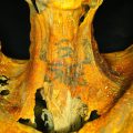 Египетская мумия с загадочными татуировками озадачила ученых - фото 2