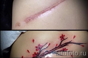 тату на шраме от аппендицита - фото пример готовой татуировки 01092016 13028 tatufoto.ru