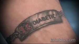 Фото тату браслета на запястье с изображением медицинского креста и надписью 'DIABETIC'. Черно-серый рисунок татуировки.