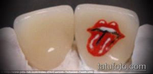 Фотография татуировки в виде языка и губ Rolling Stones на зубе. Яркий красный цвет, четкие линии, культовый символ.