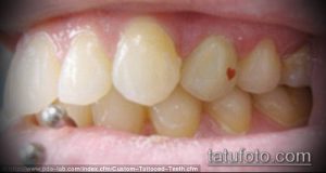 Фотография зубов с татуировками, сделанными изнутри ротовой полости. Видны различные рисунки на зубах.