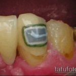 тату на зубах №528 - крутой вариант рисунка, который успешно можно использовать для доработки и нанесения как Tattoo on teeth