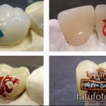 тату на зубах №13 - интересный вариант рисунка, который успешно можно использовать для переработки и нанесения как тату на зубах