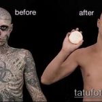 Фото Исправление и перекрытие старых тату - 12062017 - пример - 061 tattoo cover up