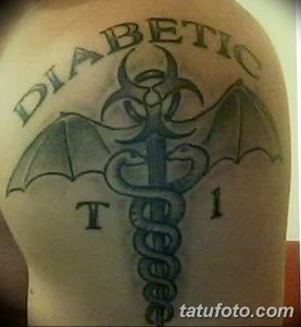 Фото татуировки Кадуцей с надписью "Diabetic" и "Type 1" на плече. Символический рисунок для людей с диабетом.