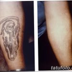 фото Выведение тату лазером от 14.01.2018 №007 - Laser tattoo removal - tatufoto.com