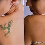 фото Выведение тату лазером от 14.01.2018 №016 - Laser tattoo removal - tatufoto.com