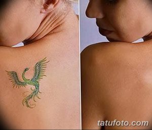 Фото тату до и после удаления: спина и шея женщины с татуировкой феникса, демонстрирующее результаты лазерного удаления.