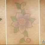 фото Выведение тату лазером от 14.01.2018 №028 - Laser tattoo removal - tatufoto.com