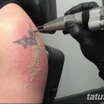 фото Выведение тату лазером от 14.01.2018 №042 - Laser tattoo removal - tatufoto.com