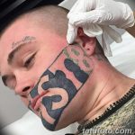 фото Выведение тату лазером от 14.01.2018 №052 - Laser tattoo removal - tatufoto.com