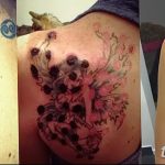 фото Выведение тату лазером от 14.01.2018 №053 - Laser tattoo removal - tatufoto.com