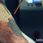 фото Выведение тату лазером от 14.01.2018 №071 - Laser tattoo removal - tatufoto.com 2526234