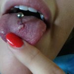 фото Пирсинг языка от 03.02.2018 №080 - tongue piercing - tatufoto.com