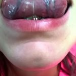 Фото пирсинга языка с двумя темными украшениями. Изображение демонстрирует открытый рот с высунутым языком, украшенным двумя пирсингами.