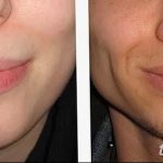 фото Виды пирсинга губы от 02.02.2018 №084 - Types of lip piercing - tatufoto.com
