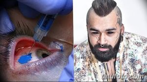 Фото тату: крупный план глаза мужчины, радужная оболочка которого окрашена в ярко-синий цвет с помощью татуировки. Процесс нанесения татуировки.