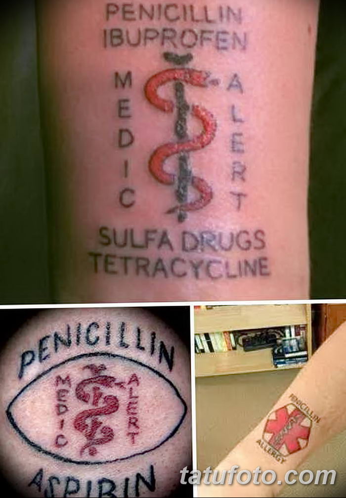 Диабет латынь. Медицинские Татуировки. Татуировки для медиков. Татуировка аллергия на пенициллин. Медицинские тату группа крови.