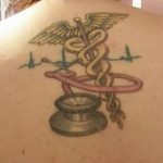 фото Медицинские тату от 22.04.2018 №032 - Medical Tattoo - tatufoto.com