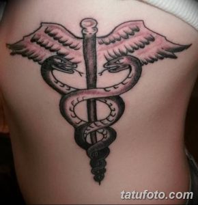 фото Медицинские тату от 22.04.2018 №036 - Medical Tattoo - tatufoto.com