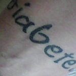 Фотография татуировки на коже с надписью 'Diabetic'. Татуировка выполнена в темных тонах, буквы немного размыты.