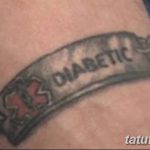 фото Медицинские тату от 22.04.2018 №043 - Medical Tattoo - tatufoto.com