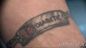 Фотография татуировки на запястье в виде браслета с надписью 'Diabetic'. Татуировка выполнена в темных тонах, с красным крестом.