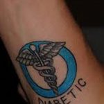фото Медицинские тату от 22.04.2018 №047 - Medical Tattoo - tatufoto.com