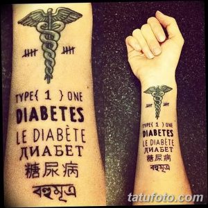 Фото тату на предплечье: посох Эскулапа, надписи 'TYPE 1 DIABETES' и текст на разных языках. Татуировка для людей с диабетом.