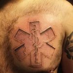 фото Медицинские тату от 22.04.2018 №061 - Medical Tattoo - tatufoto.com