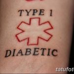 фото Медицинские тату от 22.04.2018 №071 - Medical Tattoo - tatufoto.com