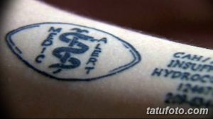Фото тату в виде синего овала с изображением змеи, обвивающей посох, и надписями 'CAH/INSULIN/HYDROCORT'. Расположение - предплечье.