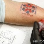 фото Медицинские тату от 22.04.2018 №094 - Medical Tattoo - tatufoto.com