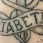 фото Медицинские тату от 22.04.2018 №102 - Medical Tattoo - tatufoto.com