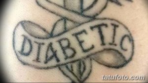 Фото тату с надписью 'Diabetic', выполненной черными чернилами. Предупреждение об опасности для медицинских работников.