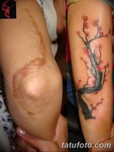 Фото тату сакуры, выполненной поверх шрама на руке. Нежные розовые цветы контрастируют с бледной кожей, символизируя исцеление и красоту.