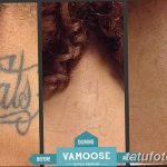 Фото удаление татуировки 21.11.2018 №010 - photo tattoo removal - tatufoto.com