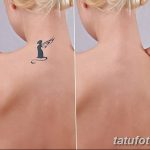 Фото удаление татуировки 21.11.2018 №016 - photo tattoo removal - tatufoto.com