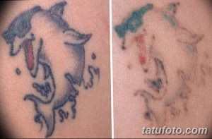 Фотография демонстрирует выцветшую татуировку с изображением дельфина на руке. Слева - татуировка в исходном состоянии, справа - после выцветания.