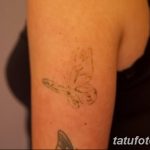 Фото удаление татуировки 21.11.2018 №021 - photo tattoo removal - tatufoto.com